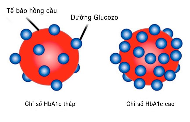 Xét nghệm HbA1C trong bệnh tiểu đường